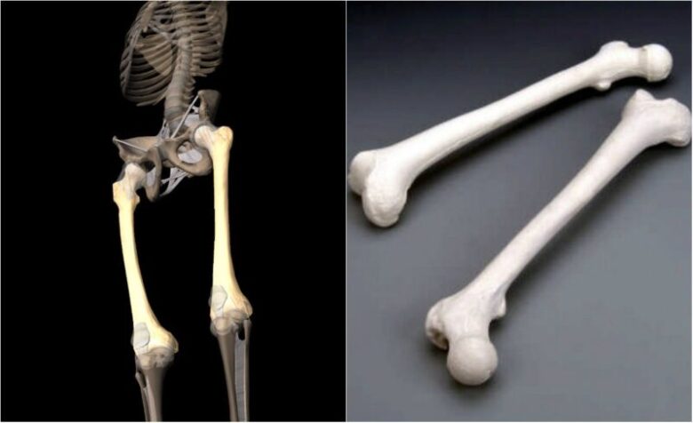 Thigh Bones Are Stronger Than Concrete Oglamo Reads